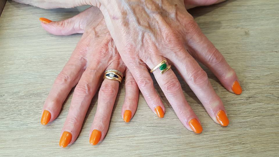 Vernis